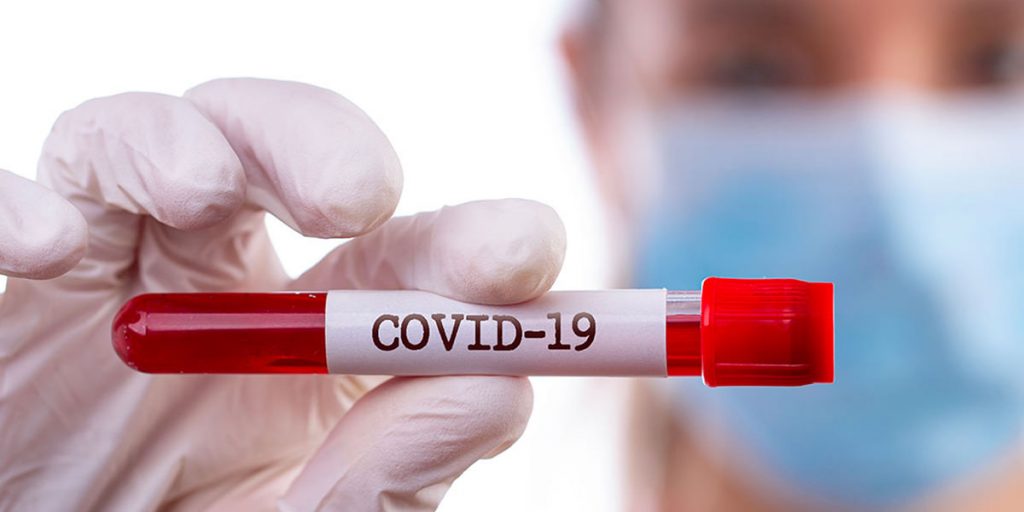 Test sierologico COVID 19 su appuntamento